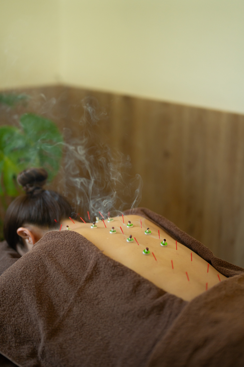 伝統鍼灸治療（90分）