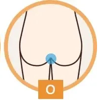 Oライン
