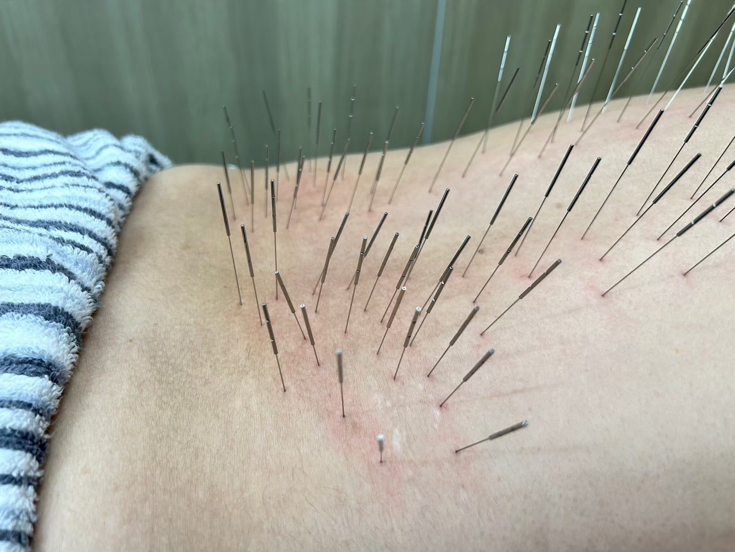 【ルート施術】身体の不調(コリ)を芯から解決  (カウンセリング込 13,000円)