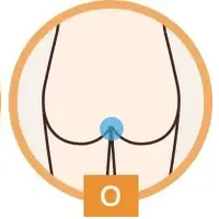 ★Oライン脱毛
