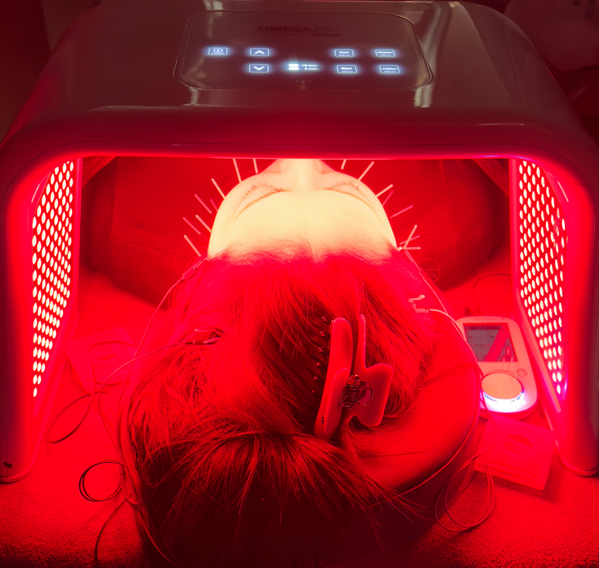 【美容鍼×３D　EMS×韓国式LED】表情筋によるシワ/加齢によるシワ