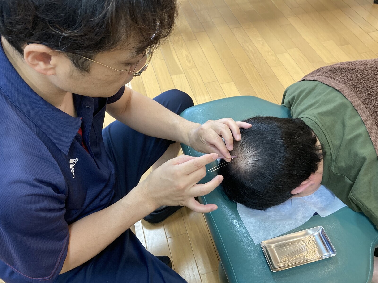 【薄毛改善鍼】※初回限定：前日までのご予約に限り