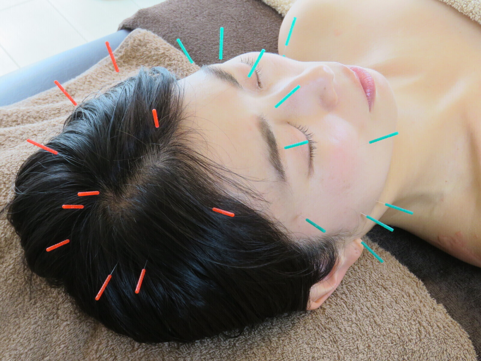 【眼精疲労・不眠】オーダーメイド鍼灸75分+初回カウンセリング｜（通常価格11,000円）