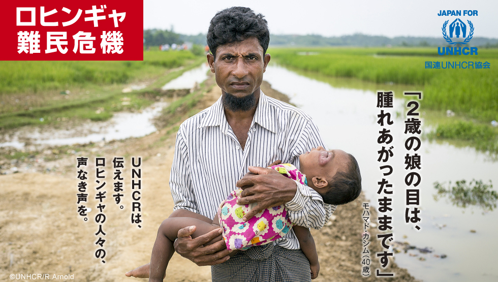 ロヒンギャ難民危機 「2歳の娘の目は、腫れあがったままです」モハマド・カシム(40歳)UNHCRは、伝えます。ロヒンギャの人々の、声なき声を。