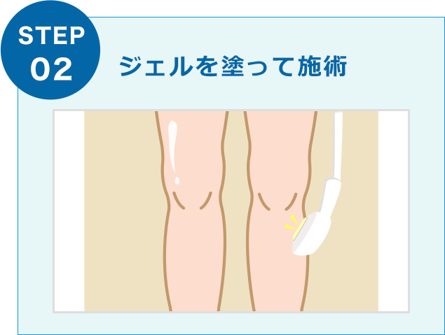 ジェルを塗って施術