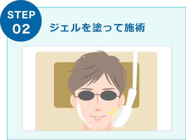 ジェルを塗って施術