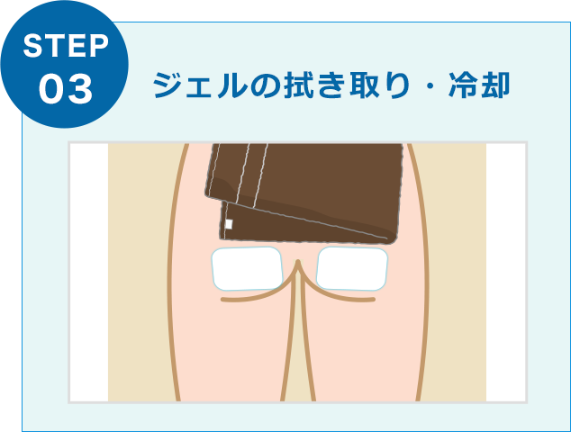 ジェルの拭き取り・冷却