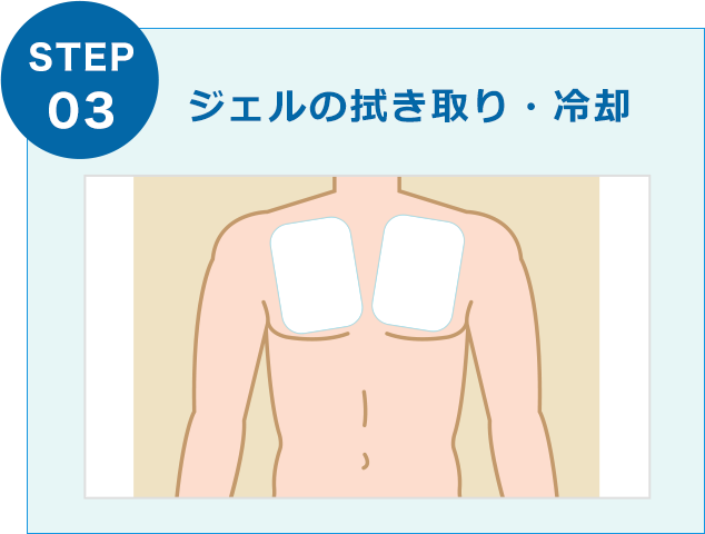 ジェルの拭き取り・冷却