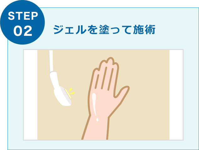 ジェルを塗って施術