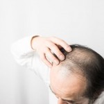 生え際のm字ハゲは生まれつき 今すぐできる対処 改善方法 ハゲケン 生え際のm字ハゲは生まれつき 今すぐできる対処 改善方法 ハゲケン