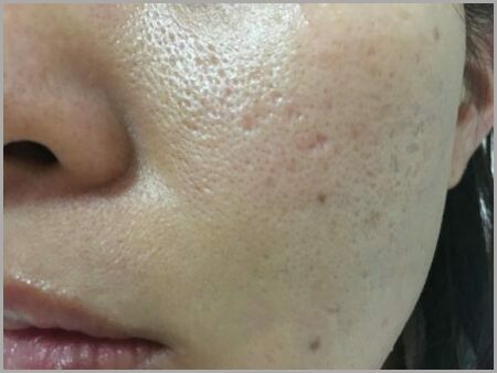 30種以上試してわかった 本当に毛穴を消したい人のための最強スキンケア