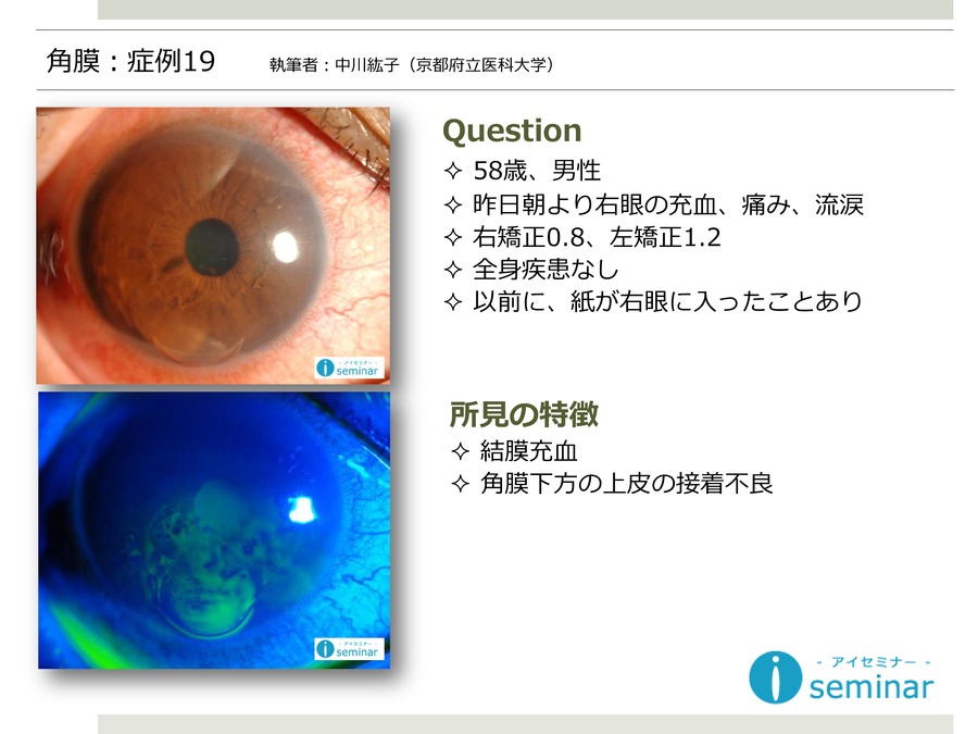 角膜：症例19