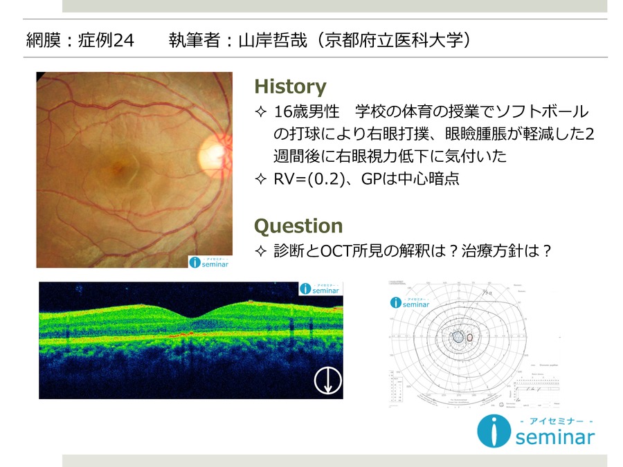 網膜：症例24