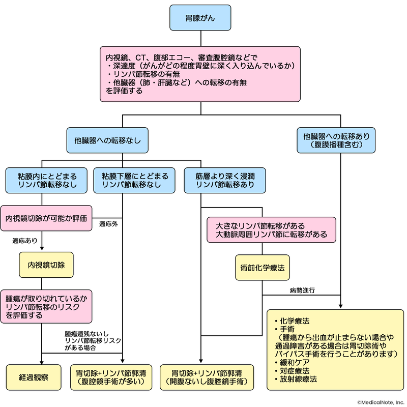 胃がん治療ガイドラインに基づいた、治療方針のおおまかな流れ