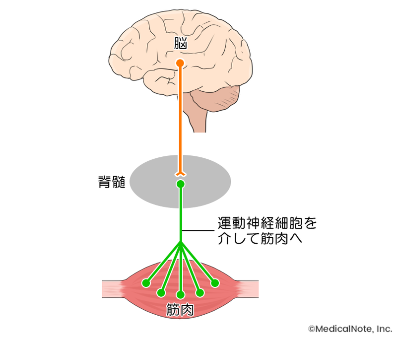 脊髄性筋萎縮症とは 乳幼児期に過度の体の柔らかさが見られたら小児神経科受診の検討を メディカルノート
