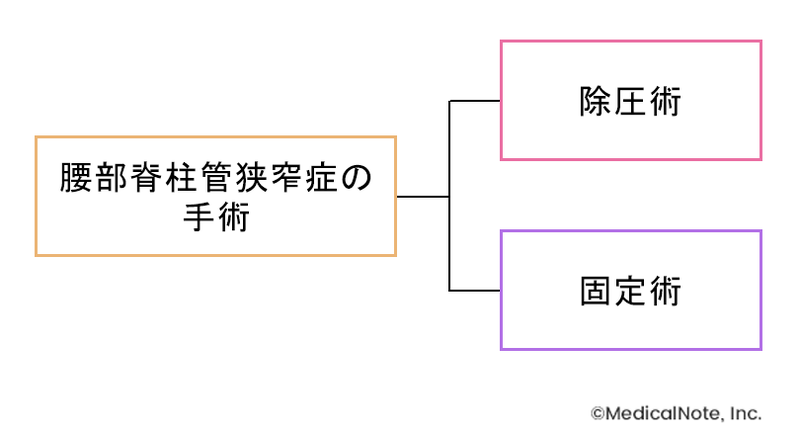 腰部脊柱管狭窄症の手術の分類