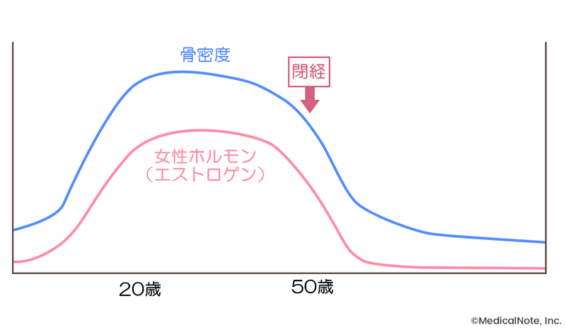 女性ホルモンと骨の深い関係