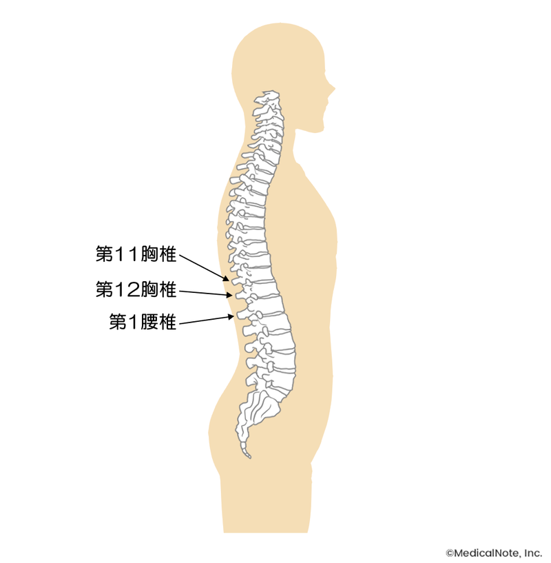骨粗しょう症による骨折が生じやすい部位
