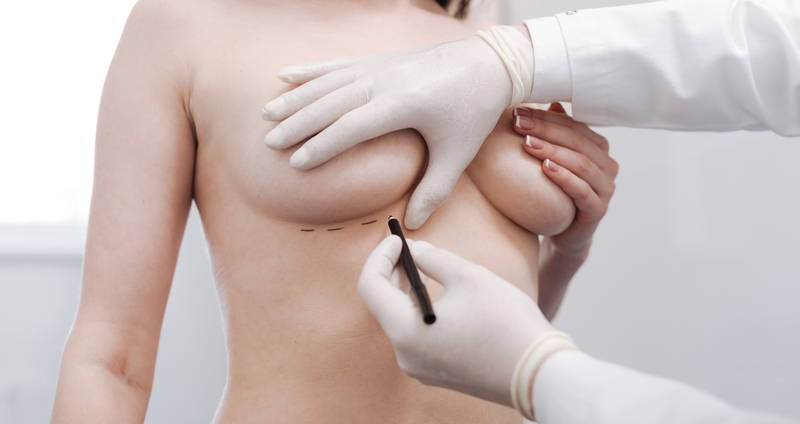 脂肪注入による乳房再建 メディカルノート