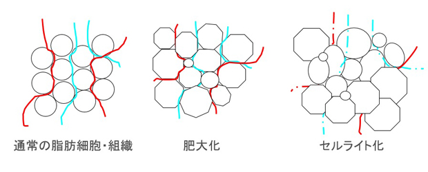 【痩せる体質ストレッチ】冷たい二の腕は要注意!肌の凹凸はセルライト化の証。