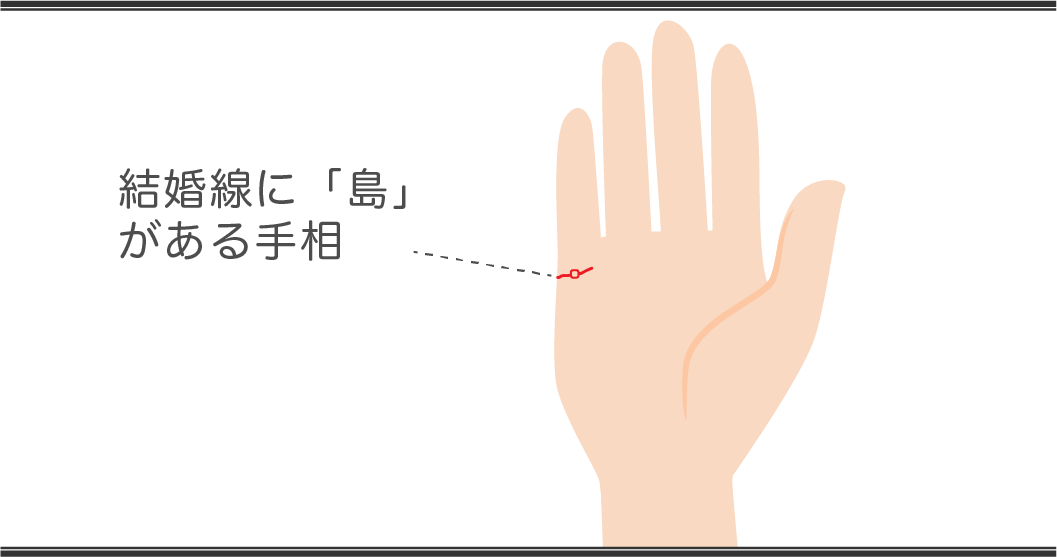 「手相占い」結婚線の見方 島がある人の手相