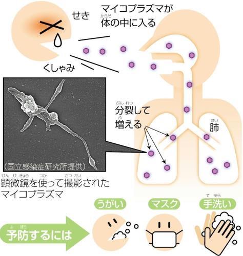 マイコプラズマ肺炎、患者数が過去最多…熱が下がった後も３～４週間せきが続くことも | ヨミドクター(読売新聞)