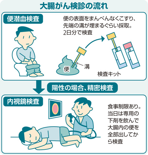大腸がんの便潜血検査、便採取を２日分から１日分に変更へ…がん発見割合に差なく負担を軽減 | ヨミドクター(読売新聞)