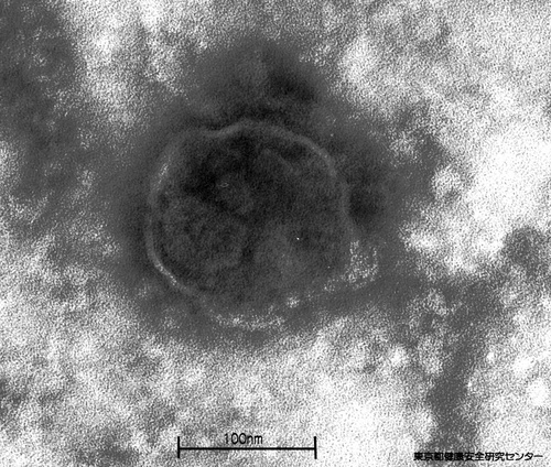 はしか猛威、東京で今月５５人…大半が１０～３０歳代 | ヨミドクター(読売新聞)