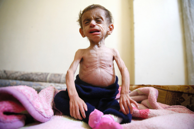 栄養失調の子ども1千人超 政権軍の包囲地区 シリア 朝日新聞デジタル ニュース Eatreat