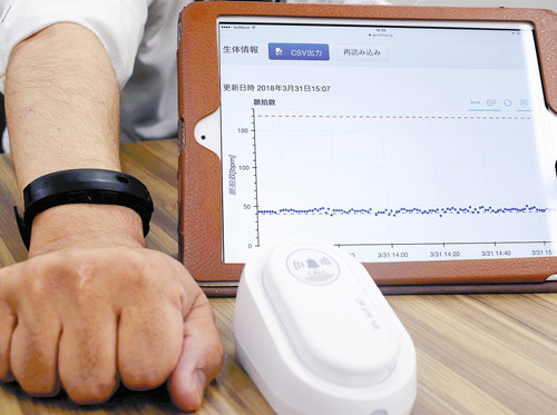 在宅患者の体調、24時間把握…リストバンド型端末が脈拍数を自動送信 : yomiDr. / ヨミドクター(読売新聞)