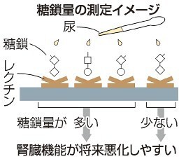 糖尿病患者尿から腎機能悪化予測　岡山大院教授ら「糖鎖」量で判定（山陽新聞デジタル） - Yahoo!ニュース