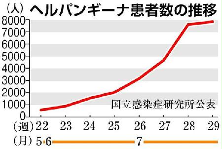 夏風邪「ヘルパンギーナ」流行 山形、新潟、静岡で「警報レベル」 - SankeiBiz(サンケイビズ)