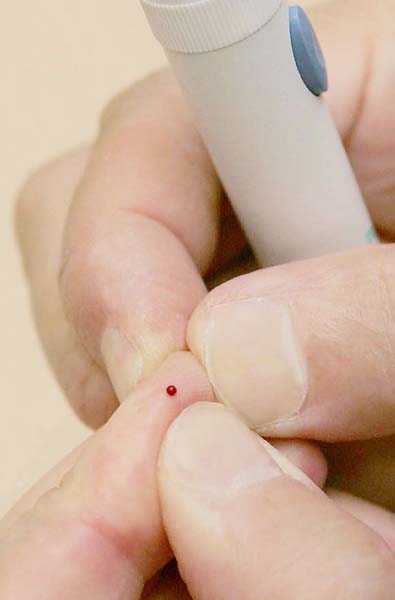 【糖尿病】食後に眠くて…ブドウ糖負荷試験で“隠れ糖尿病”を見破る｜日刊ゲンダイヘルスケア