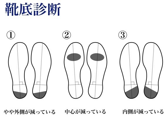 靴底の減り方で分かる足の問題点　～5パターンのうち4つはNGです～（時事通信） - Yahoo!ニュース