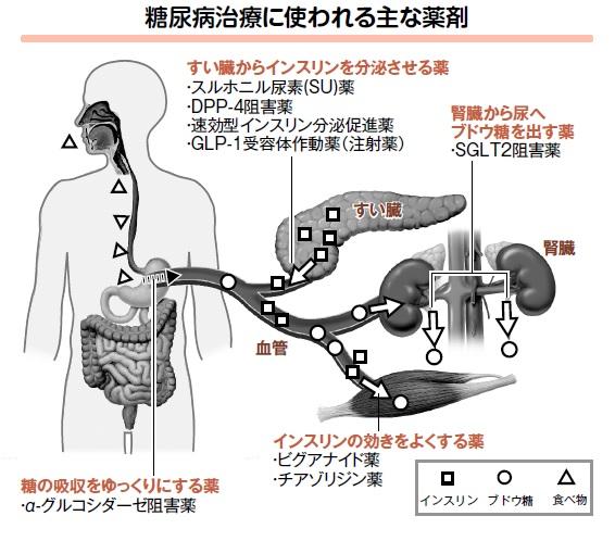 体型によって変わる糖尿病の治療薬 心筋梗塞や脳卒中が減る薬も (1/3) 〈dot.〉|AERA dot. (アエラドット)