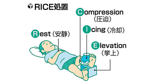 成長期のスポーツ(18)外傷 「RICE」で応急処置を : yomiDr./ヨミドクター(読売新聞)