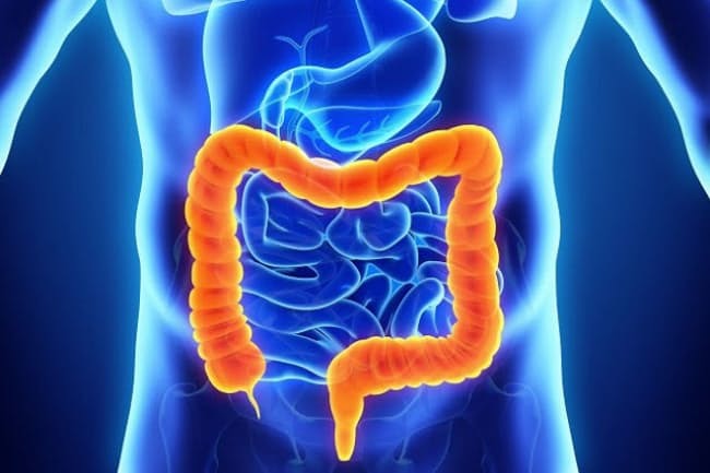 増えている大腸がん 早期発見で5年生存率は意外に…