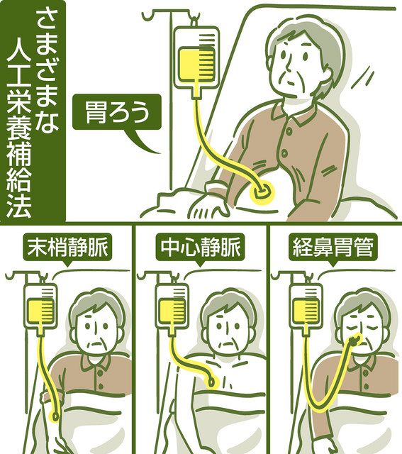 胃ろう　今の実情は？　賛否ある栄養補給法　専門家に聞く：東京新聞 TOKYO Web