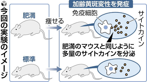 「痩せても免疫細胞が記憶」過去の肥満でも加齢黄斑変性悪化リスク…京大などチーム | ヨミドクター(読売新聞)
