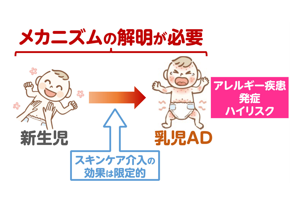 妊娠中の野菜摂取が乳児のアトピー性皮膚炎を予防する可能性|国立大学法人千葉大学のプレスリリース