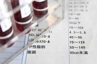 脂質異常症の食事について① コレステロールと食事の注意点