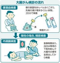 大腸がんの便潜血検査、便採取を２日分から１日分に変更へ…がん発見割合に差なく負担を軽減 | ヨミドクター(読売新聞)