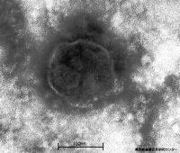 はしか猛威、東京で今月５５人…大半が１０～３０歳代 | ヨミドクター(読売新聞)
