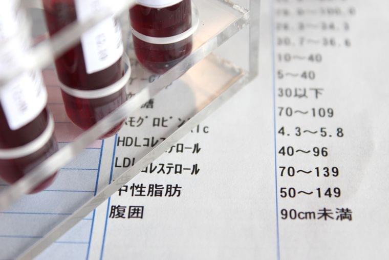脂質異常症の食事について② 中性脂肪と動脈硬化