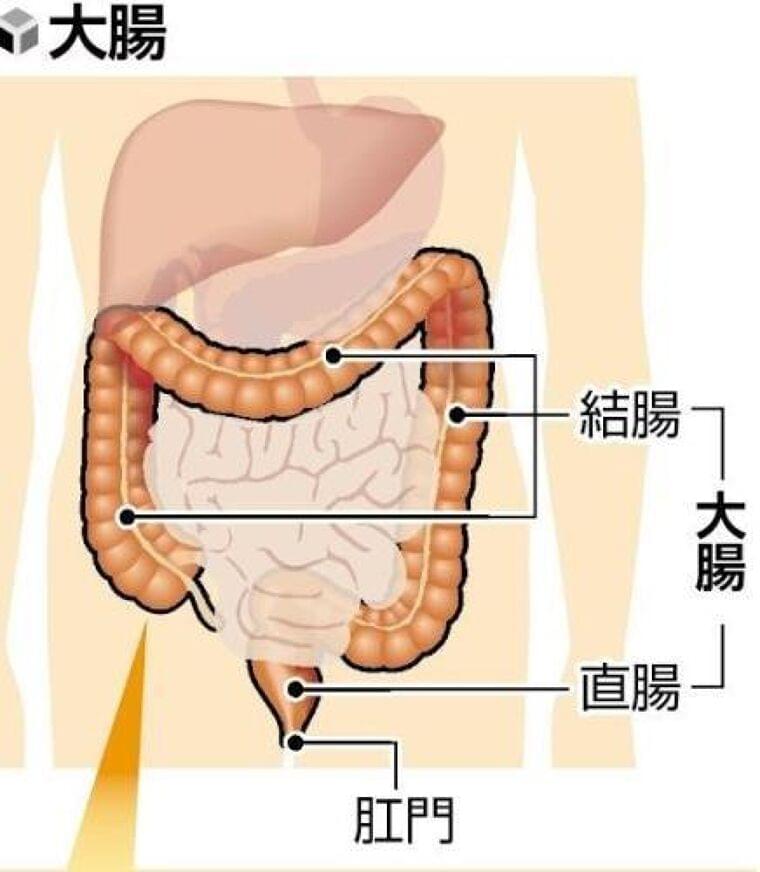 日本人に最も多い大腸がん、悪化させる体内物質を特定…京都大などの研究チーム | ヨミドクター(読売新聞)