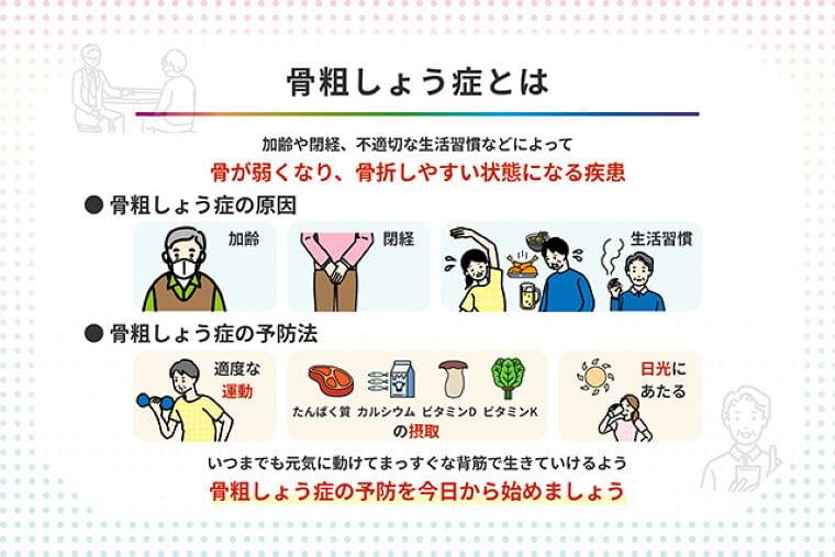 骨粗しょう症とは 原因や治療法・予防法を専門医が詳しく解説