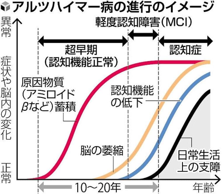 アルツハイマー病を血液検査で早期診断、米FDAが検査キット販売を初承認…富士レビオ子会社が申請 | ヨミドクター(読売新聞)