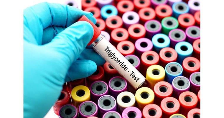 中性脂肪を下げたい 脂質、糖質どちらを減らすべき?|ヘルスUP|NIKKEI STYLE