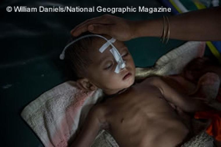 バングラデシュ:難民急増で医療需要が4倍に――MSF、緊急援助を強化 | 活動ニュース | 国境なき医師団日本