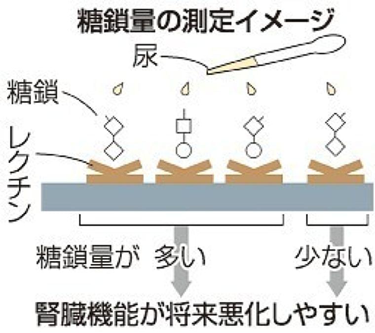 糖尿病患者尿から腎機能悪化予測　岡山大院教授ら「糖鎖」量で判定（山陽新聞デジタル） - Yahoo!ニュース
